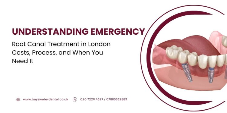 Understanding Emergency Root Canal Treatment in London: Costs, Process, and When You Need It