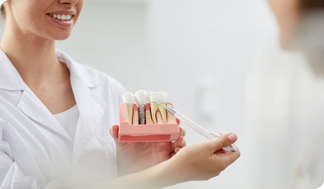 The Best Solution for Missing Teeth in Surrey Canada – Dental Implants